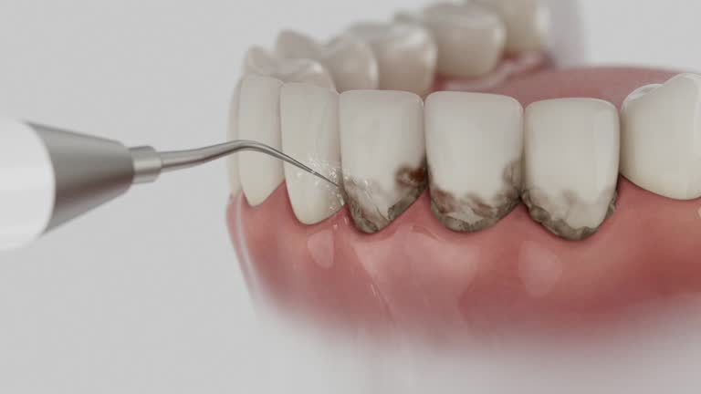 Reliable Dental Implants contractor in Independence, LA by Smile Center Dentistry